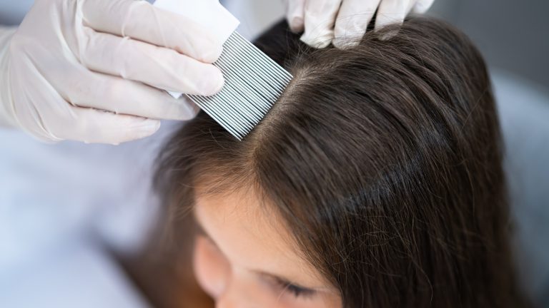 Why Do Lice Treatment Prices Vary So Much?