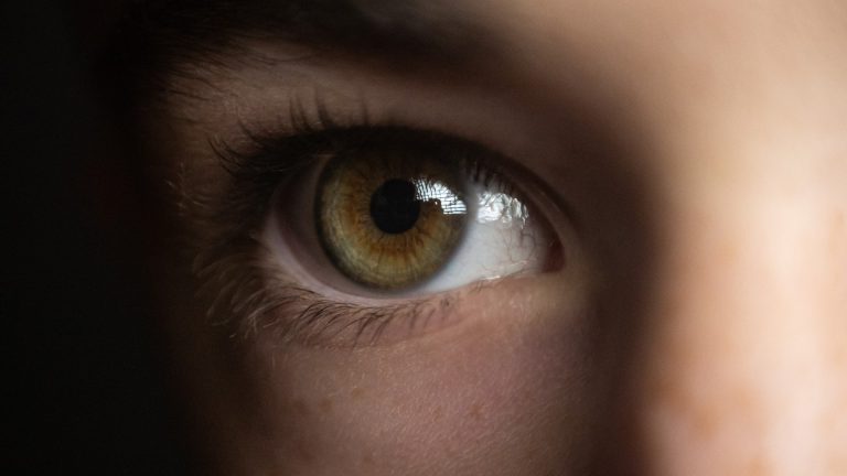 Are Those Really Nits on Your Eyelashes?