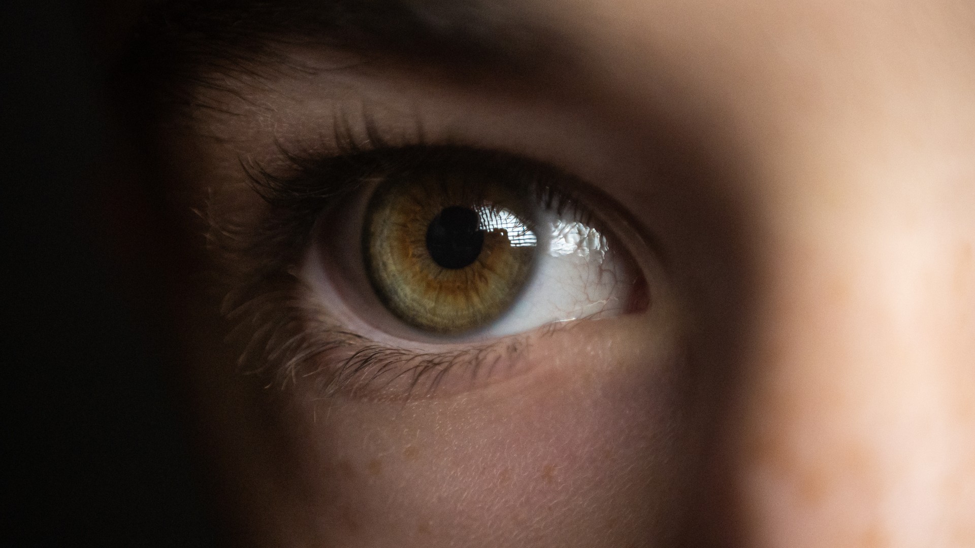 Are Those Really Nits on Your Eyelashes?