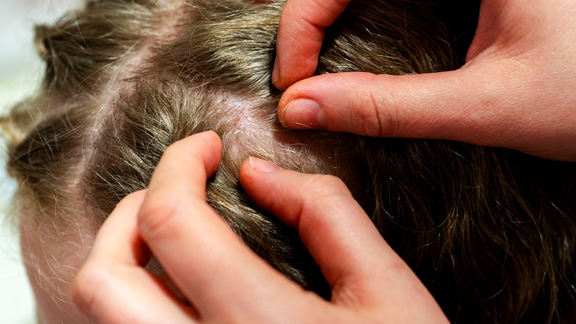 Young woman applying coconut oil to her hair in a bright home bathroom, the kind of at-home remedy parents reach for after a lice diagnosis