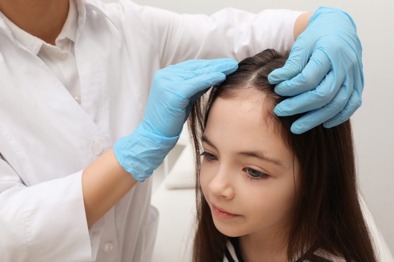Do You Need a Doctor to Treat Your Child’s Lice?