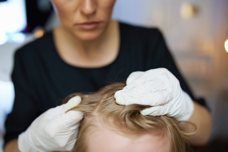 White-gloved hands separating light hair to examine the scalp.