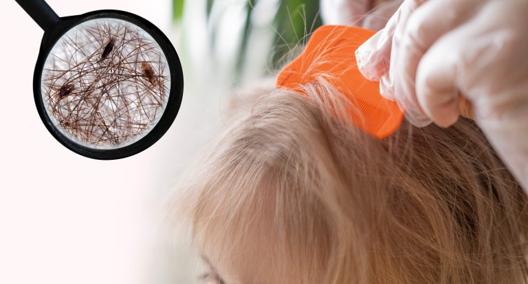 Found Lice on Your Child? Start With the Whole House
