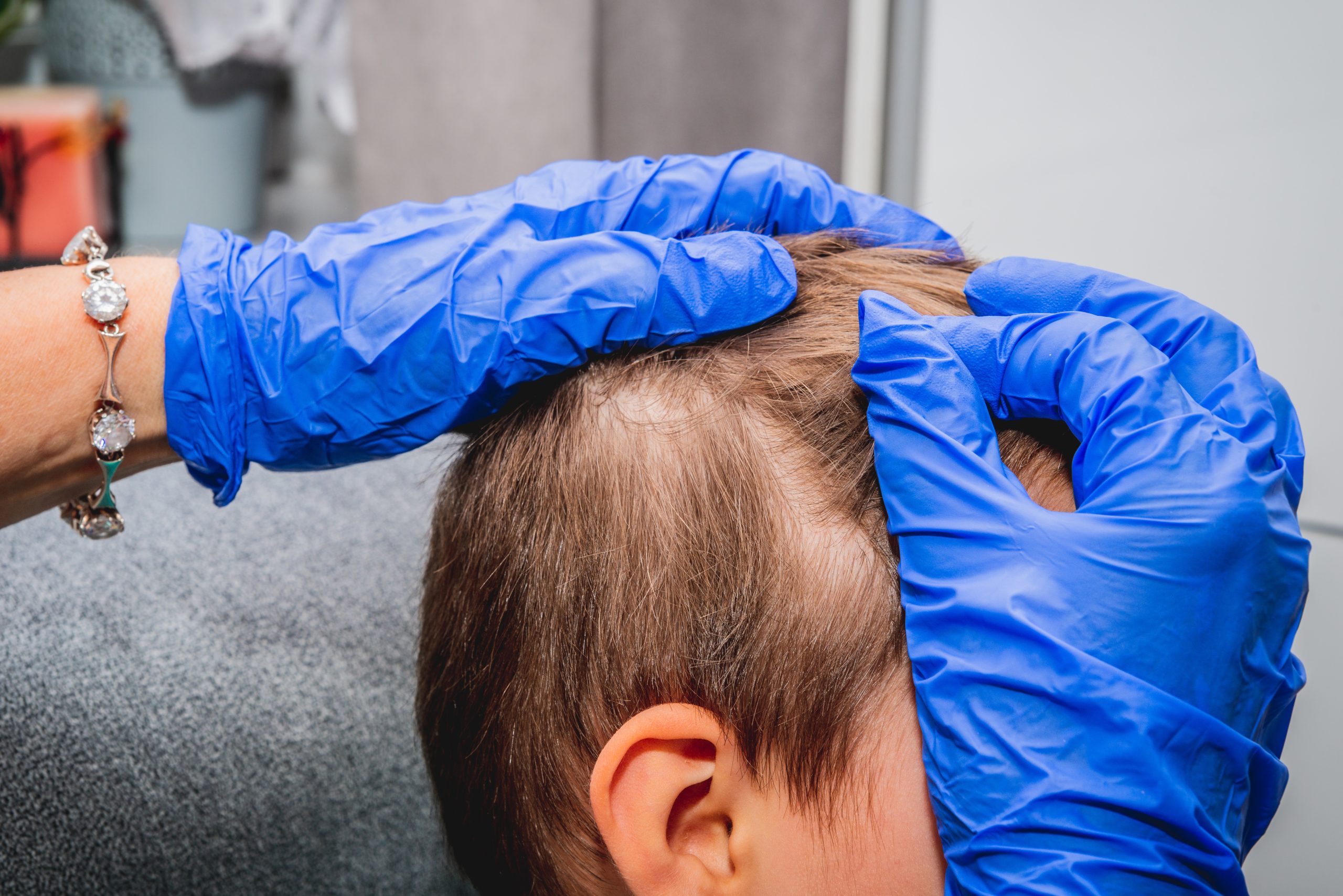 Checking the child's hair. Health and pharmaceutical concept, child health problems. The doctor checks the child's hair, head lice, possible lice inf ... See More