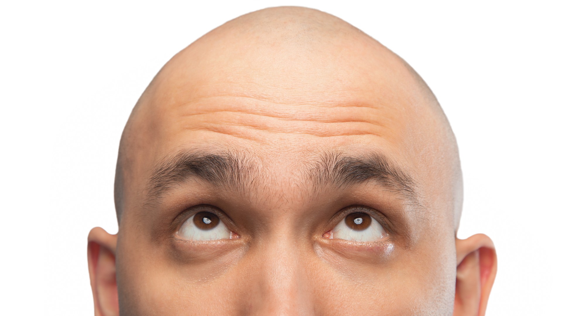 Why a Shaved Head Isn’t Safe From Head Lice