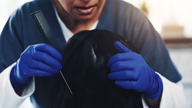 Why the First Sign of Lice Is an Itch Behind the Ears