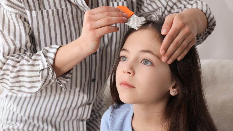 Three Bugs Can Itch a Scalp. Only One Lives There.