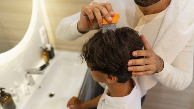Wet Hair and Conditioner Are Why a Lice Treatment Fails