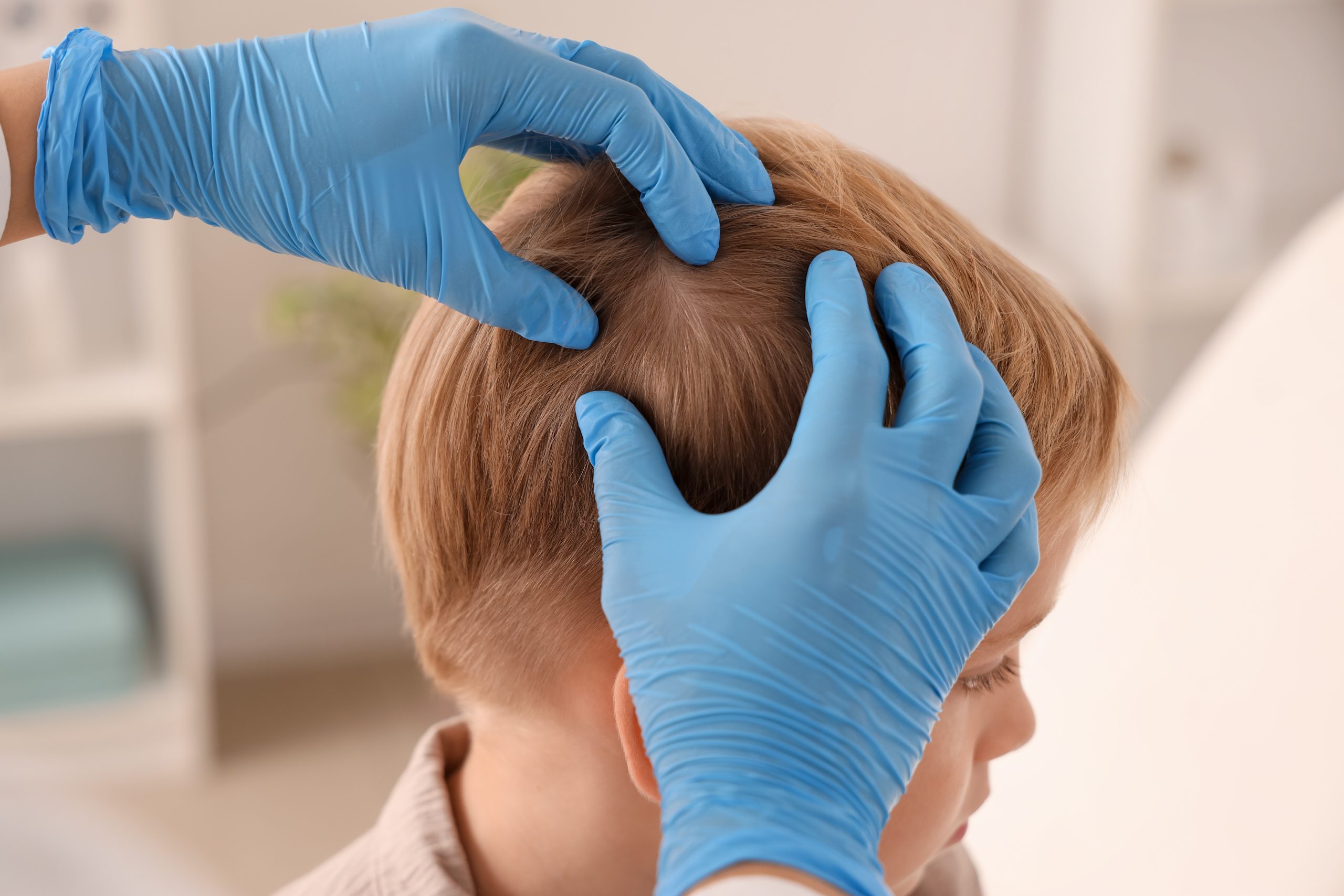 Gloved hands parting a child's fair hair to examine the scalp